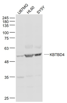 KBTBD4 Rabbit Polyclonal Antibody