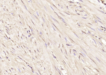 JMJD5 Rabbit Polyclonal Antibody