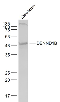 DENND1B Rabbit Polyclonal Antibody