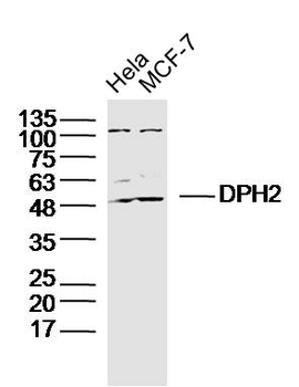 DPH2 Rabbit Polyclonal Antibody