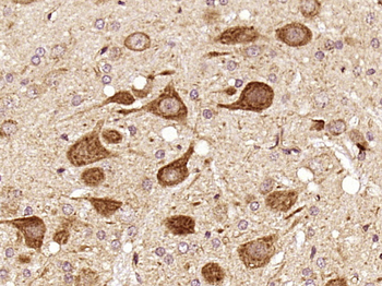 CCDC83 Rabbit Polyclonal Antibody