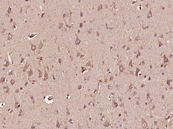 CCDC92 Rabbit Polyclonal Antibody