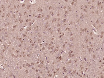 CCDC92 Rabbit Polyclonal Antibody