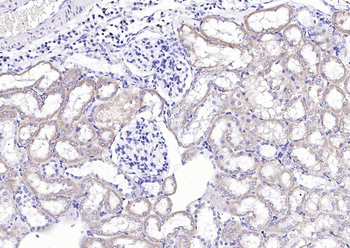 CCDC92 Rabbit Polyclonal Antibody
