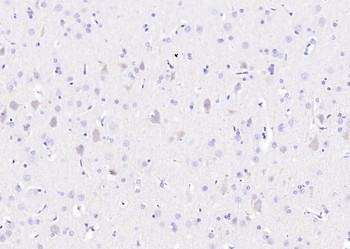 CCDC92 Rabbit Polyclonal Antibody