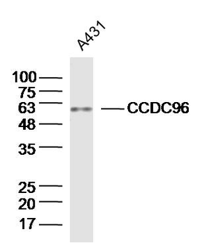 CCDC96 Rabbit Polyclonal Antibody