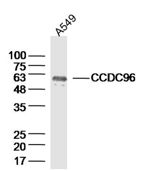 CCDC96 Rabbit Polyclonal Antibody