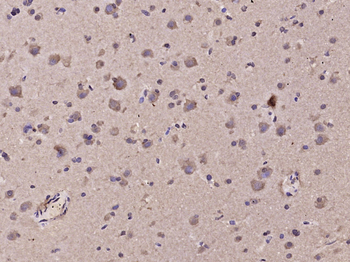 TRP12/TRPV4 Rabbit Polyclonal Antibody