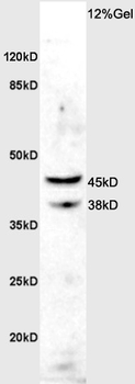 ASMTY Rabbit Polyclonal Antibody