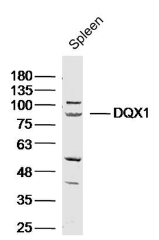 DQX1 Rabbit Polyclonal Antibody