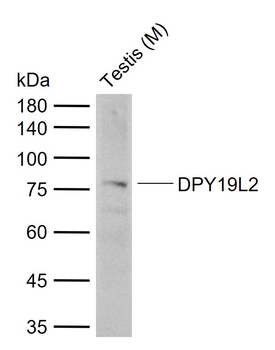 DPY19L2 Rabbit Polyclonal Antibody