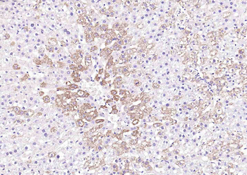 Matriptase 2 Rabbit Polyclonal Antibody