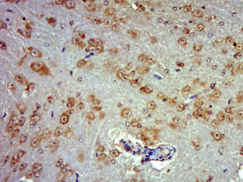 STK25 Rabbit Polyclonal Antibody