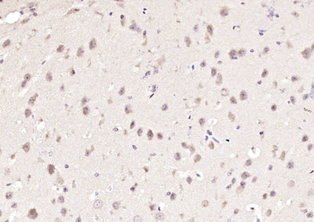 UBE2D3 Rabbit Polyclonal Antibody
