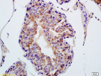 TXNRD1 Rabbit Polyclonal Antibody