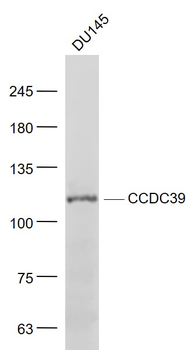CCDC39 Rabbit Polyclonal Antibody