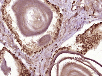 CCDC30 Rabbit Polyclonal Antibody