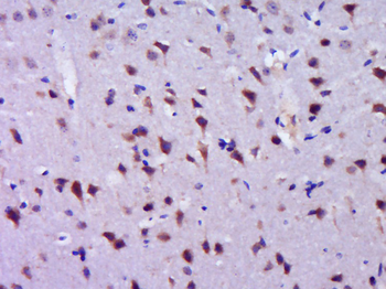 CCDC90B Rabbit Polyclonal Antibody