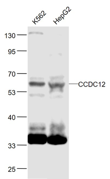CCDC12 Rabbit Polyclonal Antibody