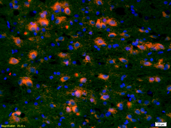 CCDC12 Rabbit Polyclonal Antibody