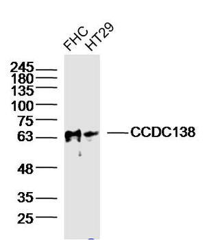 CCDC138 Rabbit Polyclonal Antibody