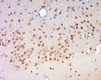 CCDC160 Rabbit Polyclonal Antibody