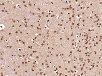 CCDC42 Rabbit Polyclonal Antibody