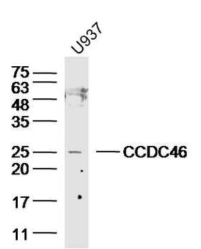 CCDC46 Rabbit Polyclonal Antibody