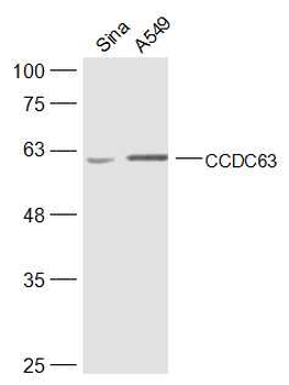 CCDC63 Rabbit Polyclonal Antibody