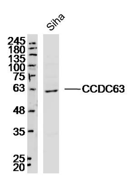 CCDC63 Rabbit Polyclonal Antibody