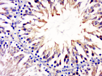 CCDC54 Rabbit Polyclonal Antibody