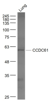 CCDC61 Rabbit Polyclonal Antibody