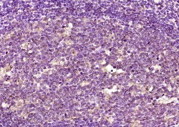 CCDC8 Rabbit Polyclonal Antibody