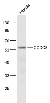 CCDC8 Rabbit Polyclonal Antibody