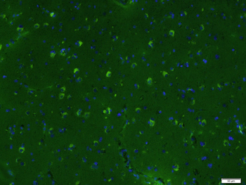 ABCB6 Rabbit Polyclonal Antibody (BF488)