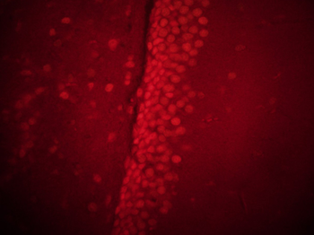 LMX1b Rabbit Polyclonal Antibody (BF555)