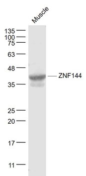 ZNF144 Rabbit Polyclonal Antibody