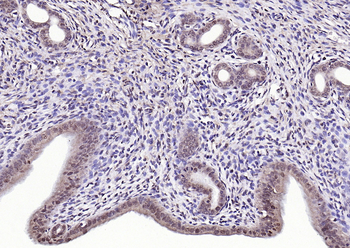 NPD014 Rabbit Polyclonal Antibody