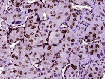 MYF5 Rabbit Polyclonal Antibody