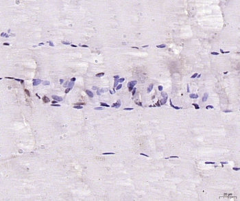 MYF5 Rabbit Polyclonal Antibody