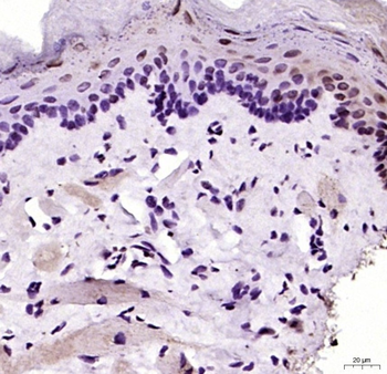 MYF5 Rabbit Polyclonal Antibody