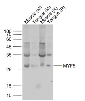 MYF5 Rabbit Polyclonal Antibody
