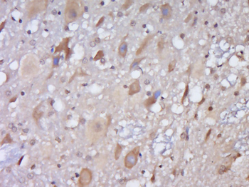 SHFM3 Rabbit Polyclonal Antibody