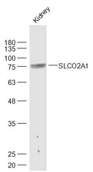 SLCO2A1 Rabbit Polyclonal Antibody