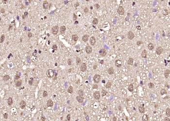 SKP1 Rabbit Polyclonal Antibody