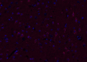 VIP Rabbit Polyclonal Antibody (BF555)