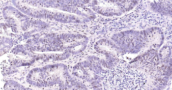 Human ki-67 Ready-To-Use IHC Kit