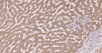 Human P4HB Ready-To-Use IHC Kit