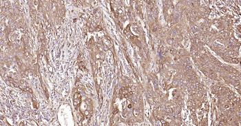 Human HSP47 Ready-To-Use IHC Kit