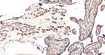 Human HSP47 Ready-To-Use IHC Kit